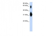 ARP57899_P050 - SOX15