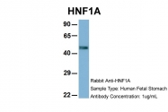 ARP57904_P050 - HNF1 alpha / TCF1