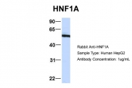 ARP57904_P050 - HNF1 alpha / TCF1