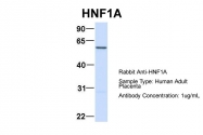 ARP57904_P050 - HNF1 alpha / TCF1