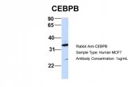ARP57940_P050 - CEBPB