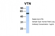 ARP58095_P050 - Vitronectin