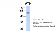 ARP58095_P050 - Vitronectin