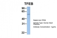 ARP58116_P050 - TFEB