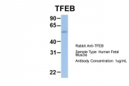 ARP58116_P050 - TFEB