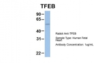 ARP58116_P050 - TFEB