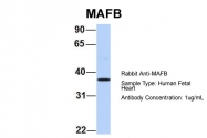ARP58149_P050 - MAFB