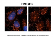 ARP58157_P050 - HMGB2 / HMG2