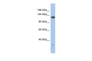 ARP58207_P050 - JMJD2B / KDM4B