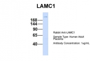 ARP58233_P050 - Laminin gamma 1