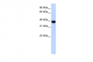 ARP58402_P050 - CDK1