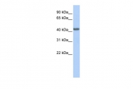 ARP58409_P050 - CD192 / CCR2