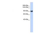 ARP58413_P050 - Alpha-actinin-1 / ACTN1