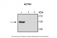 ARP58413_P050 - Alpha-actinin-1 / ACTN1