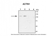 ARP58413_P050 - Alpha-actinin-1 / ACTN1