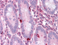ARP58457_P050 - EEF2
