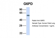 ARP58469_P050 - G6PD