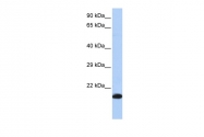 ARP58473_P050 - Glutathione peroxidase 4 / GPX4