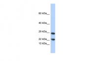 ARP58490_P050 - Lipocalin-8