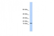 ARP58491_P050 - Galectin-1