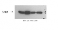 ARP58529_P050 - Superoxide dismutase 2 / SOD2