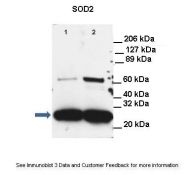 ARP58529_P050 - Superoxide dismutase 2 / SOD2