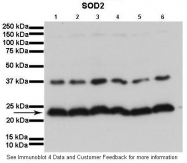 ARP58529_P050 - Superoxide dismutase 2 / SOD2
