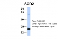 ARP58529_P050 - Superoxide dismutase 2 / SOD2