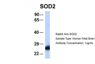 ARP58529_P050 - Superoxide dismutase 2 / SOD2