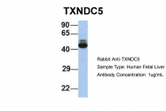 ARP58547_P050 - TXNDC5 / TLP46
