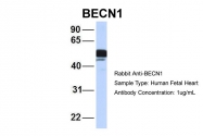 ARP58595_P050 - Beclin-1