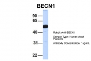 ARP58595_P050 - Beclin-1
