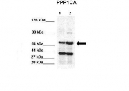 ARP58652_P050 - PPP1CA