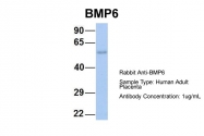 ARP58756_P050 - BMP6