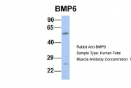 ARP58756_P050 - BMP6
