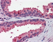 ARP58818_P050 - WNT3A