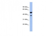 ARP58818_P050 - WNT3A