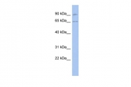 ARP58820_P050 - RASGRP2