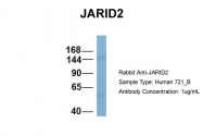 ARP58842_P050 - JARID2 / Jumonji