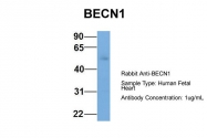 ARP58874_P050 - Beclin-1