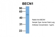 ARP58874_P050 - Beclin-1
