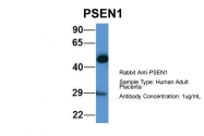 ARP58941_P050 - Presenilin-1