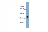 ARP58959_P050 - STK11