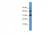 ARP58995_P050 - Caspase-7