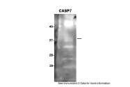 ARP58995_P050 - Caspase-7