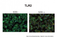 ARP59036_P050 - CD282 / TLR2