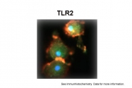 ARP59036_P050 - CD282 / TLR2