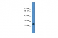 ARP59093_P050 - CD27