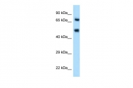 ARP59109_P050 - CD62E / E-Selectin