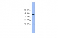 ARP59177_P050 - Cystatin-B